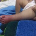 Instituto de Medicina Tropical: familiares preocupados por operación de pie de una bebé – Nacionales